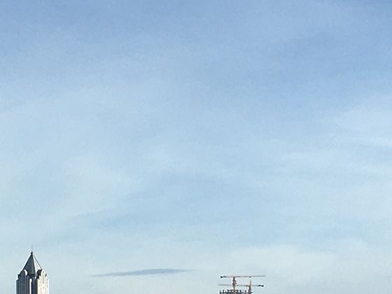 手脚麻木/刺痛？糖尿病周围神经病变的早期表现，可能比血糖高更早出现